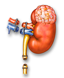 Laparoscopic Nephrectomy